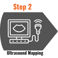Step 2: ultrasound mapping
